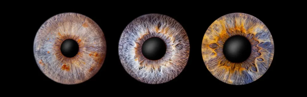 irisfoto_dreier_beispiel_01_web